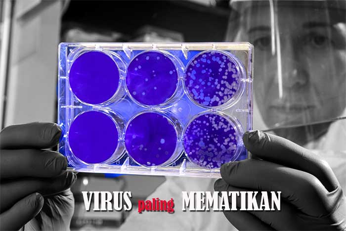 4 Virus Mematikan Yang Pernah Terjadi Di Dunia